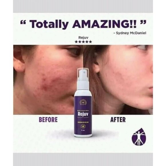 COPY - Rejuv Body & Face Spray 3 fl oz —10 bottles - Picture 5 of 5